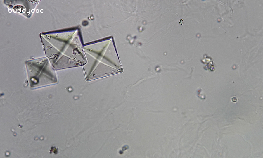 microscopic image of calcium oxalate